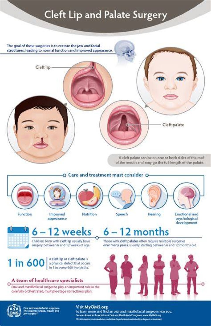 cleft lip treatment
